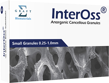 InterOss SigmaGraft 골이식재 제품 이미지